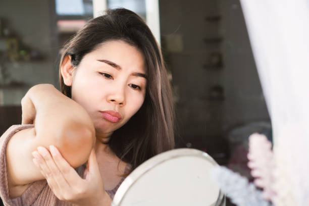 Asian woman checking her dry, damage and dark skin on elbows.