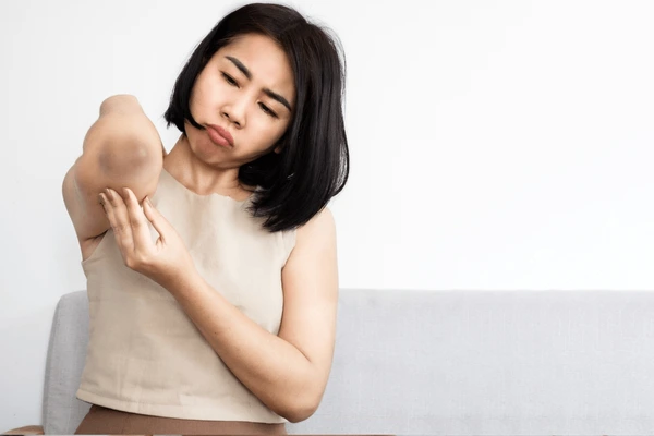 Asian woman having problem black elbows.