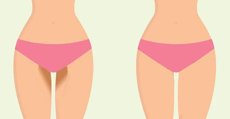 Dark Inner Thighs Image.